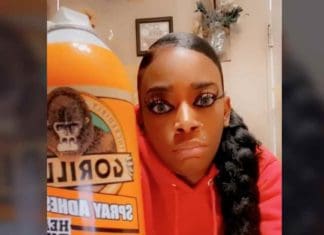 LA doctor will treat Gorilla Glue girl for free