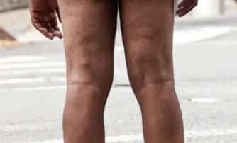 Sickos of NYC: Masturbation, Exhibitionism Up 51%