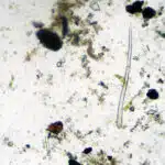 A “Zombie Worm,” Frozen 24,000 Years Ago, Was Revived & Immediately Reproduced