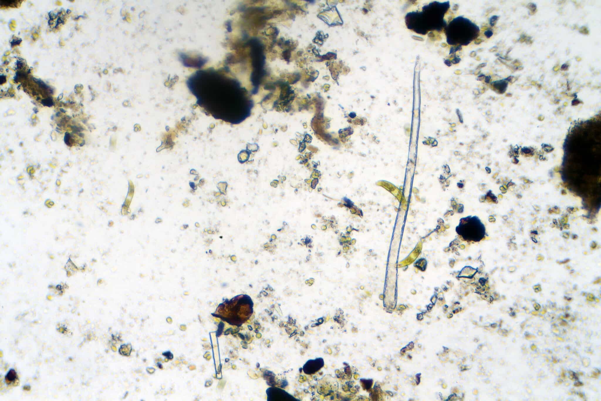 A “Zombie Worm,” Frozen 24,000 Years Ago, Was Revived & Immediately Reproduced